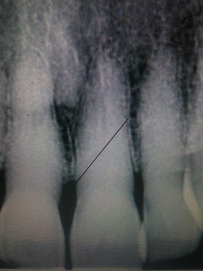 Img 7015 a1vlg8 - Eugenol
