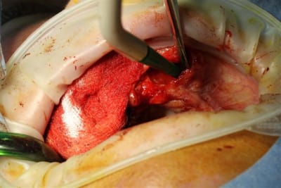 Img 7154 u34co2 - Eugenol