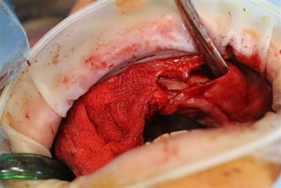 Img 7163 oczctm - Eugenol