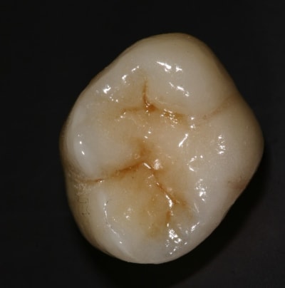 Img 7273 tr5oix - Eugenol