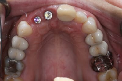 Img 7276 cfwxvf - Eugenol