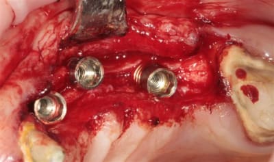 Img 7586 lfm2vo - Eugenol