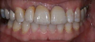 Img 7618 pebzhk - Eugenol