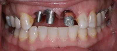 Img 7622 cj5iol - Eugenol