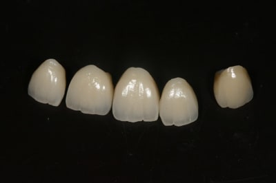 Img 7716 tqfsq0 - Eugenol