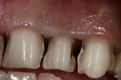 Img 7736 pce6se - Eugenol