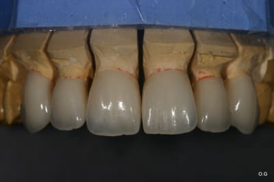 Img 7757 qicif8 - Eugenol