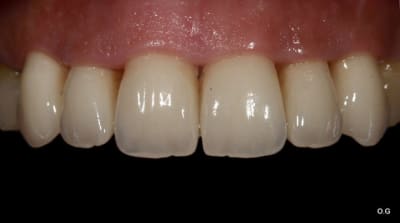 Img 7809 xudebd - Eugenol