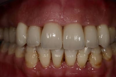 Img 7810  custom  nbint8 - Eugenol
