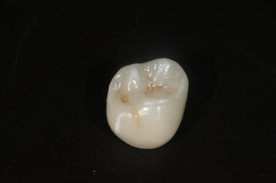 Img 7834  large  nzfcrn - Eugenol