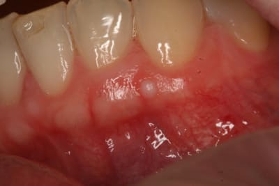 Img 8387 d2uwsb - Eugenol