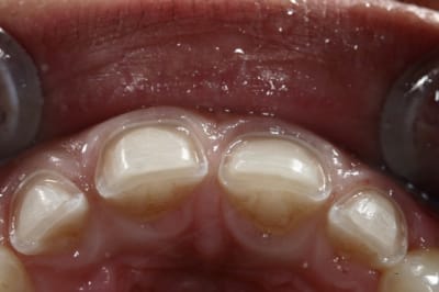 Img 8599 v0caww - Eugenol