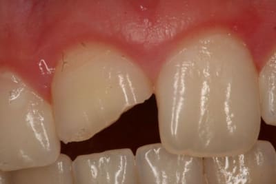 Img 8858 hp2qut - Eugenol