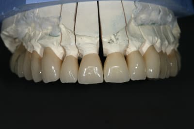 Img 9028 nhtg7u - Eugenol