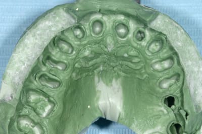 Img 9061 zitgw4 - Eugenol