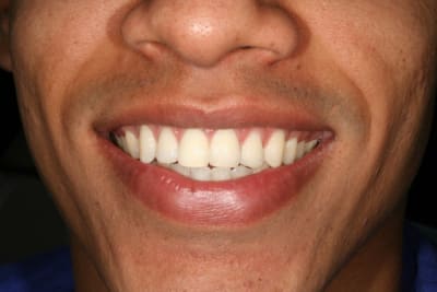 Img 9088 hp12r9 - Eugenol