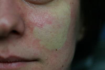 Img 9153 wvex9v - Eugenol