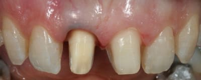 Img 9481 xf4u0b - Eugenol