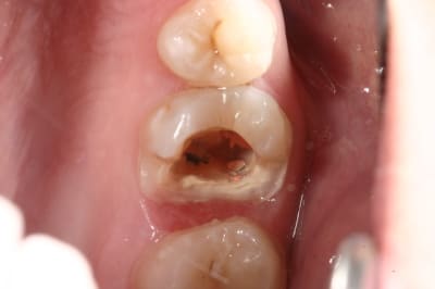 Img 9536 cnuuwp - Eugenol