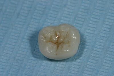 Img 9705 ddivj4 - Eugenol