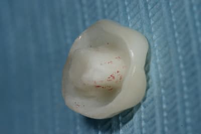 Img 9706 qhvobi - Eugenol