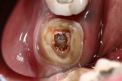 Img 9708 qahegg - Eugenol