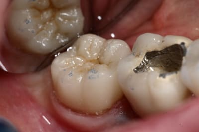 Img 9713 mydix4 - Eugenol