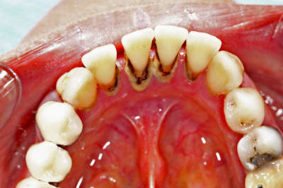 Img 9733 txmmbz - Eugenol