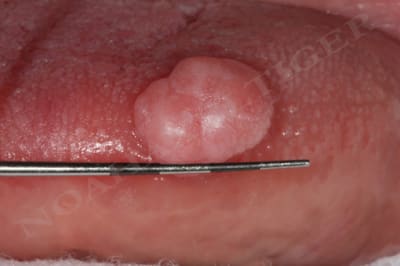 Img 9918 hrhxlu - Eugenol