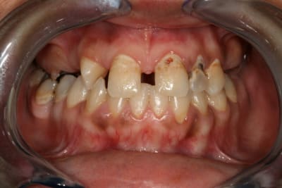 Img 9994 glflbe - Eugenol