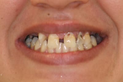 Img 9997 001 chi9xv - Eugenol