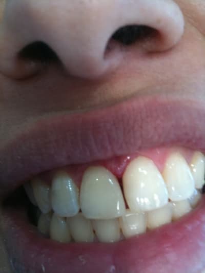 Iphone 070 xdpc2i - Eugenol