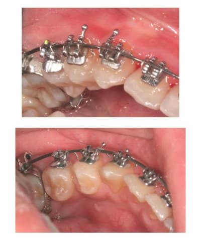 Image 11 pvszac - Eugenol