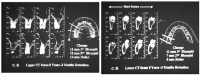 Image 3 im1cqs - Eugenol