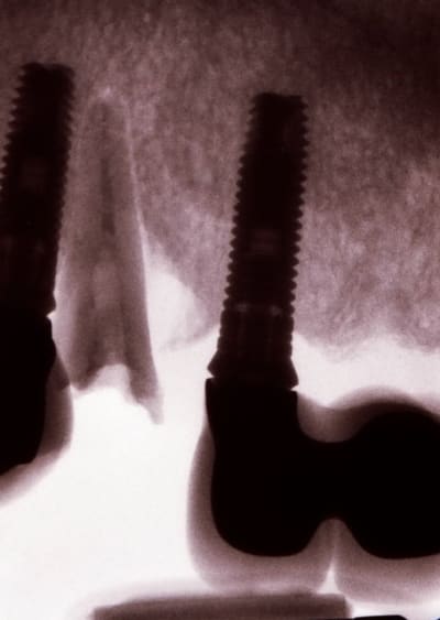 Image0001 xrpgu9 - Eugenol