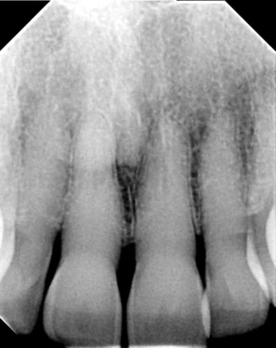 Image000 hkxaam - Eugenol