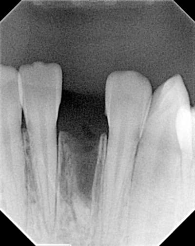 Image000 r0tmqg - Eugenol