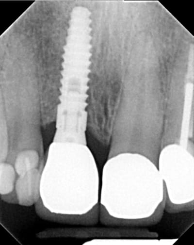 Image000 rbxopj - Eugenol