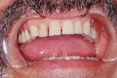 Image10 qgfypz - Eugenol