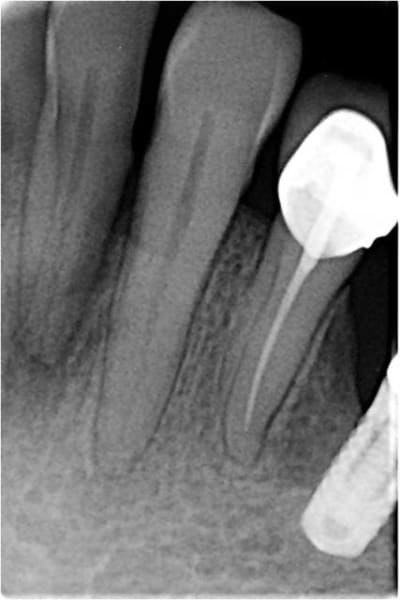 Image10 tmi6rc - Eugenol