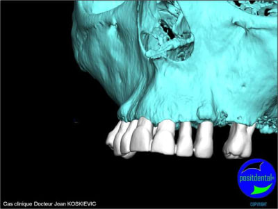 Image11 dhtw4i - Eugenol