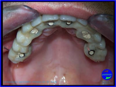 Image11 mp5ogx - Eugenol