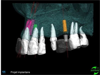 Image11 qvvbph - Eugenol