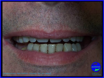 Image12 qr2fcf - Eugenol