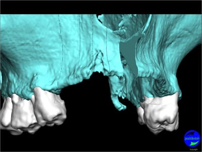 Image12 xki16i - Eugenol