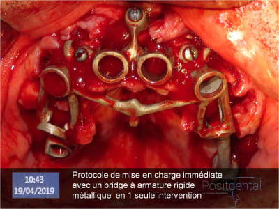 Image13 ikpqik - Eugenol