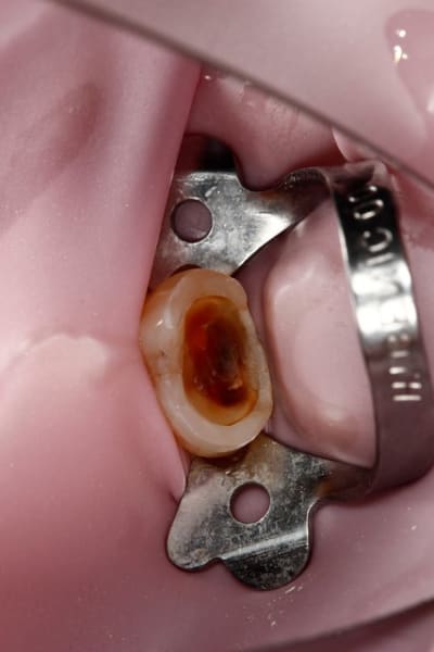 Image14 lgh4tw - Eugenol