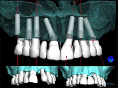 Image15 kommls - Eugenol