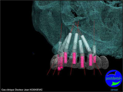 Image16 ypxwgv - Eugenol