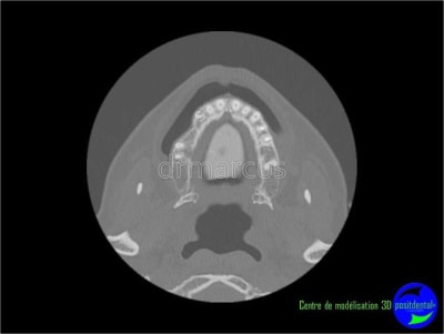 Image17 aw0gsw - Eugenol